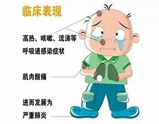 禽流感症状主要表现有哪些